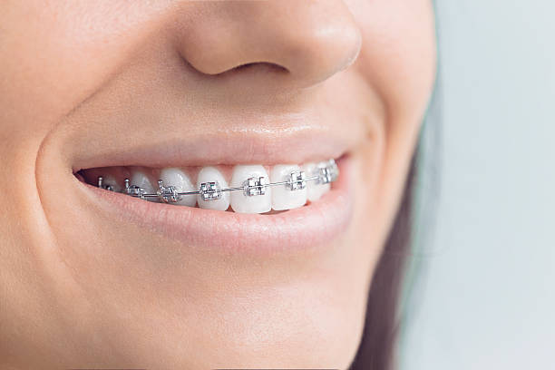 Why Choose Us for Your Dental Needs in Timonium, MD